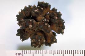 Kaltsiy oksalat toshlari