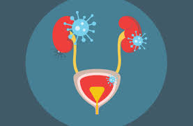 SIYDIK YO'LLARI INFEKTSIYALARI (SYI)