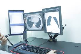 Kompyuter tomografiyasini qanchalik tez-tez bajarish mumkin?