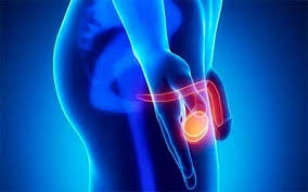 Moyak anomaliyalari yoki tug'ma nuqsonlari