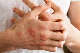 Dermatologik muammolar