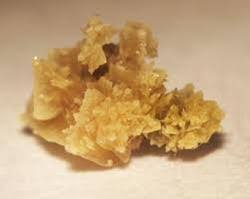 Siydik kislota toshlari