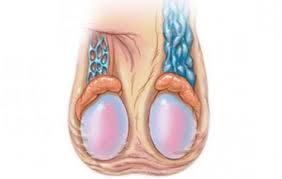 Varikotsele va uni davolash